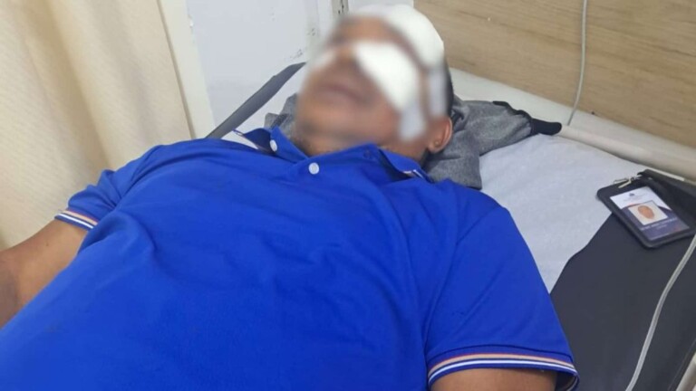 Motoconchistas agreden a chofer del TRAE tras roce con motor que transitaba en vía contraria