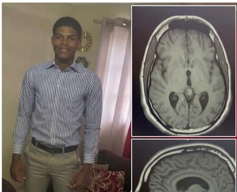 Joven de 16 años lucha contra un tumor cerebral y pide ayuda para cumplir su sueño de ser pelotero